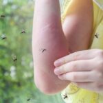 Sivrisineklerin isirma sebebi sandigimizdan baska belirli kisiler hedefte LQ6FuWHV